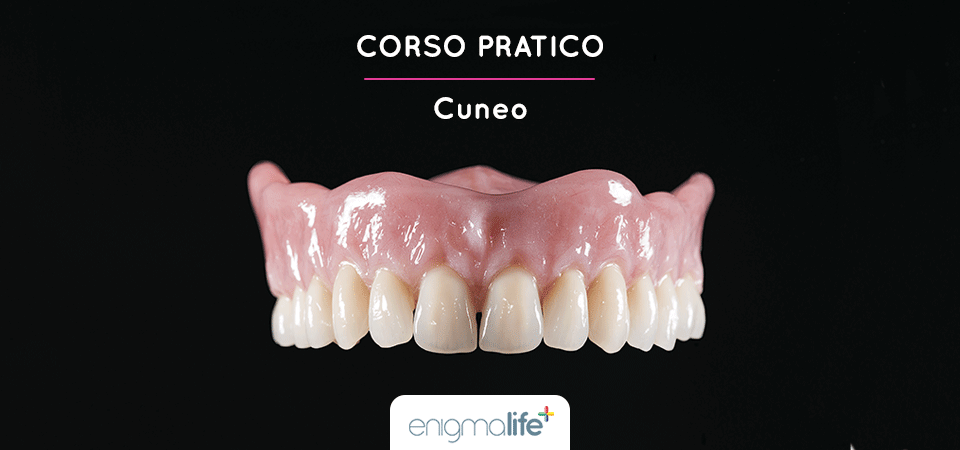 Protesi esteticamente naturali e biologicamente funzionali: corso pratico, Cuneo