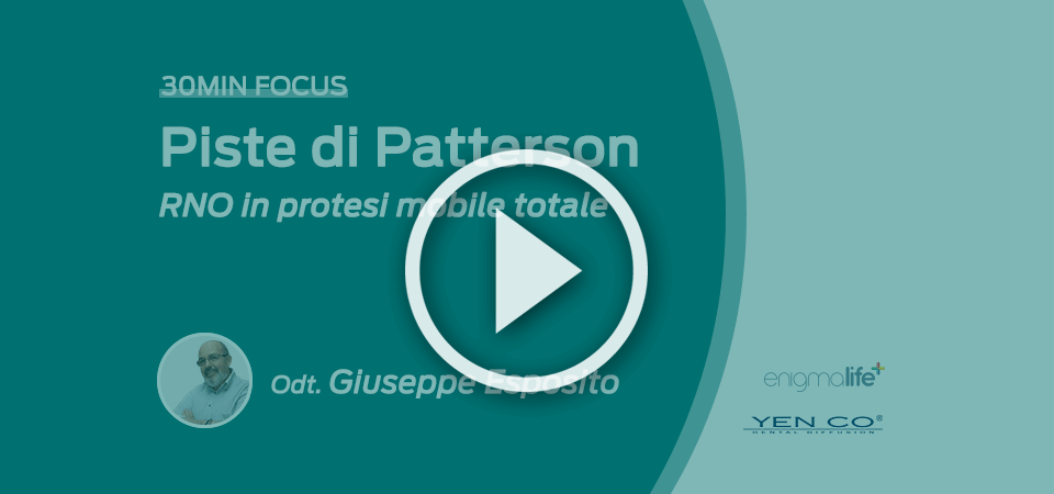 VIDEO CORSO PREMIUM | Piste di Patterson