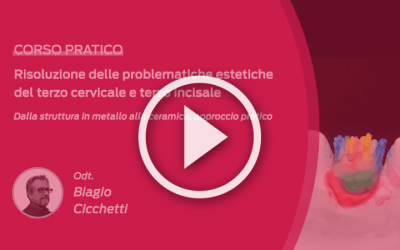 Risoluzione problematiche estetiche terzo cervicale e terzo incisale: video corso pratico