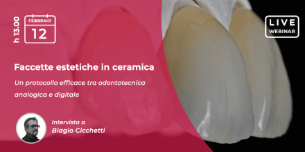 webinar faccette estetiche ceramica febbraio 2021