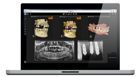 cs-imaging-versione-8 impronta digitale
