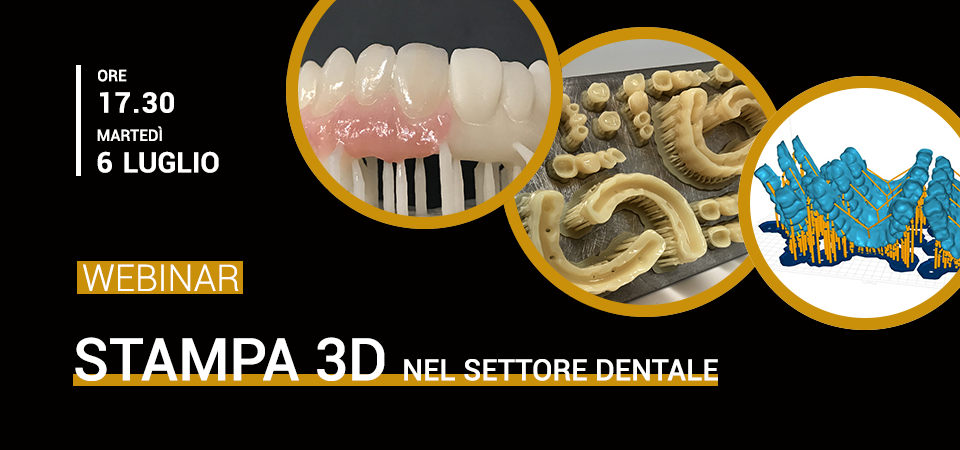 Stampa 3D nel settore Dentale
