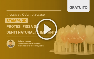 Incontra l’odontotecnico: STAMPA 3D – Protesi fissa su denti naturali e impianti, video