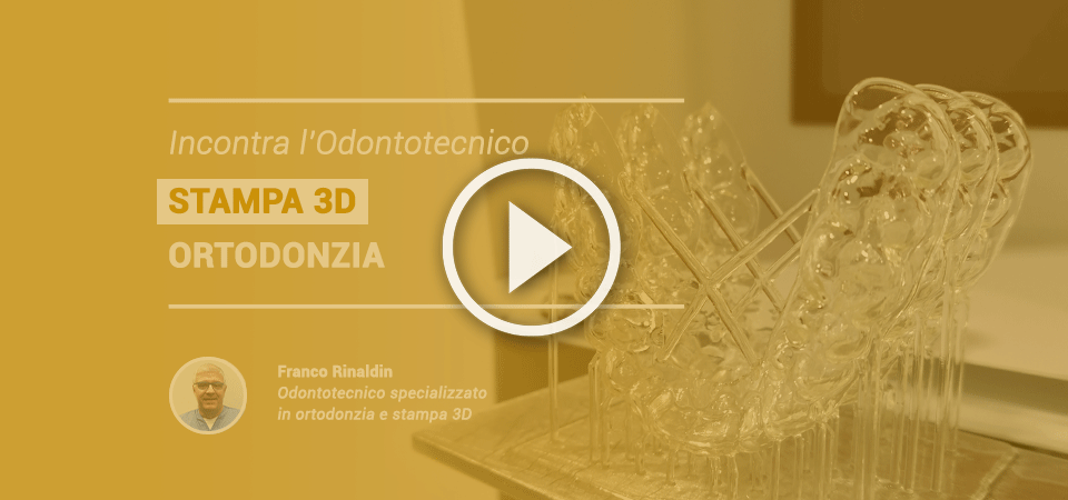 VIDEO | Incontra l’odontotecnico: Stampa 3D – Ortodonzia