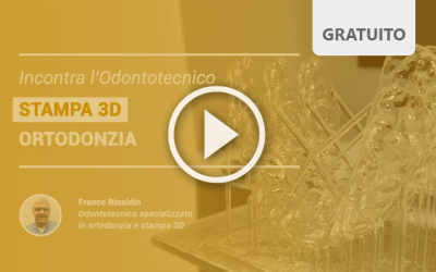 Incontra l’odontotecnico: STAMPA 3D – Ortodonzia, video