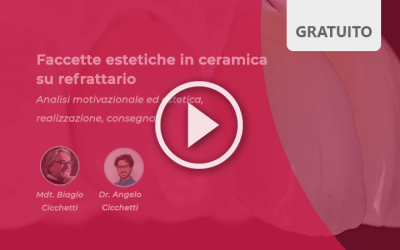 Faccette in ceramica su refrattario: analisi motivazionale ed estetica, realizzazione, consegna, video