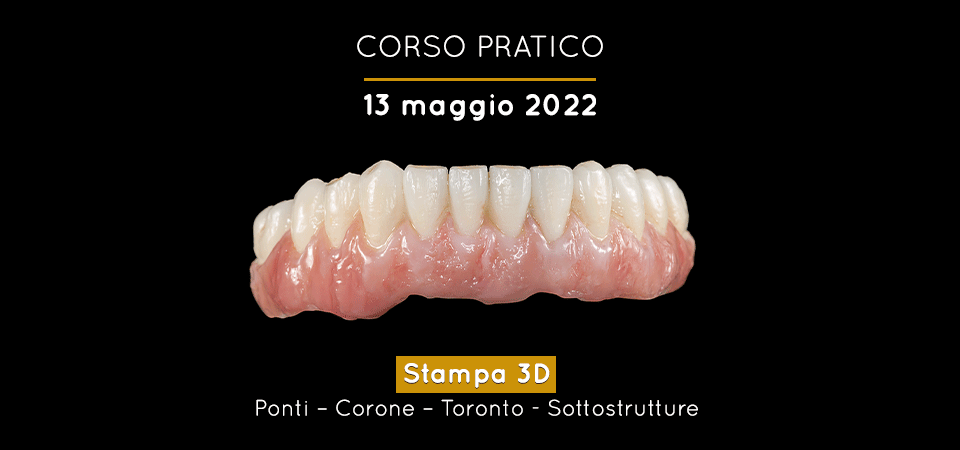 Utilizzo di resine 3D certificate per la stampa di manufatti protesici definitivi e a lungo termine | Maggio 2022