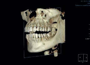 panoramico-3d-rayscan-fov-massima-risoluzione
