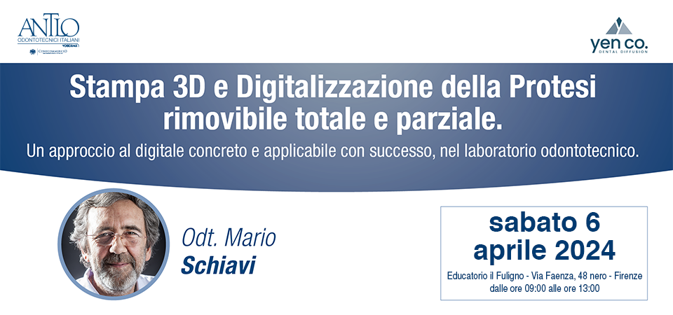 Stampa 3D e Digitalizzazione della Protesi rimovibile totale e parziale, Firenze