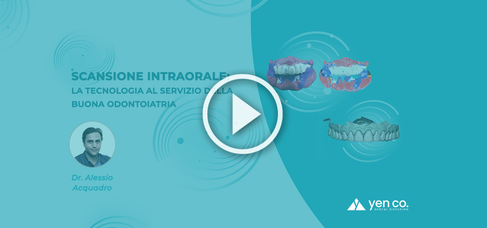 VIDEO | Scansione Intraorale: la tecnologia al servizio della buona odontoiatria