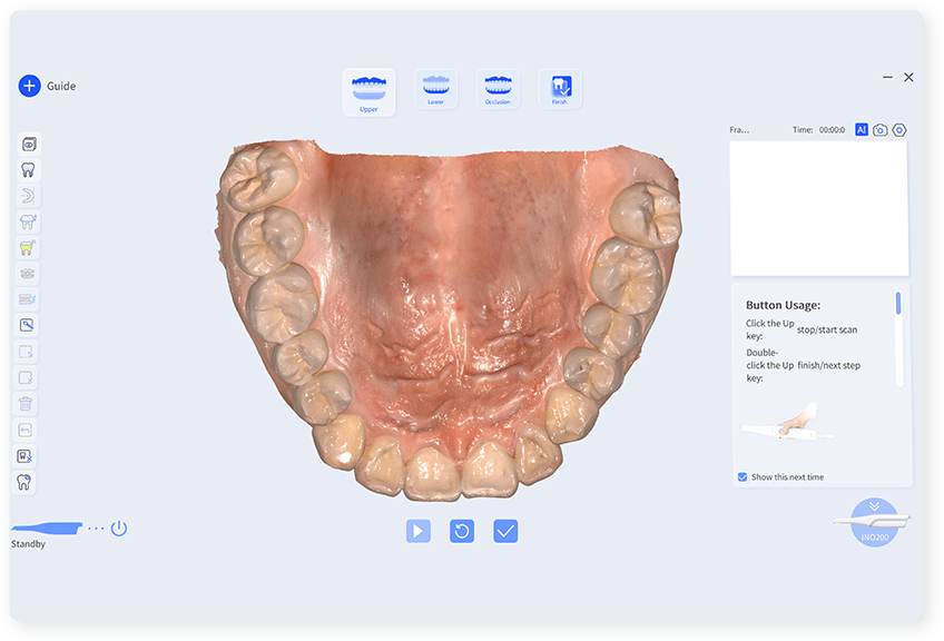 Intraoral-scanner-INO200-feature6-software