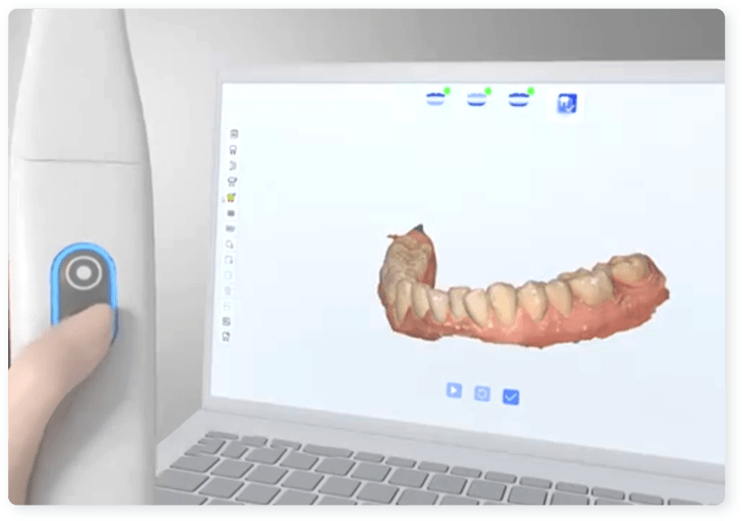 Intraoral-scanner-INO200-feature7-smart-control