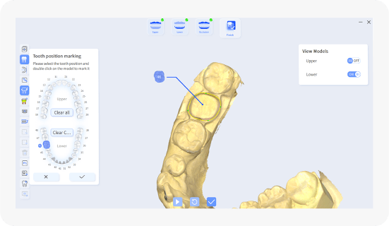 intraoral-scanner-INO200-new-clinical-toolkit-1
