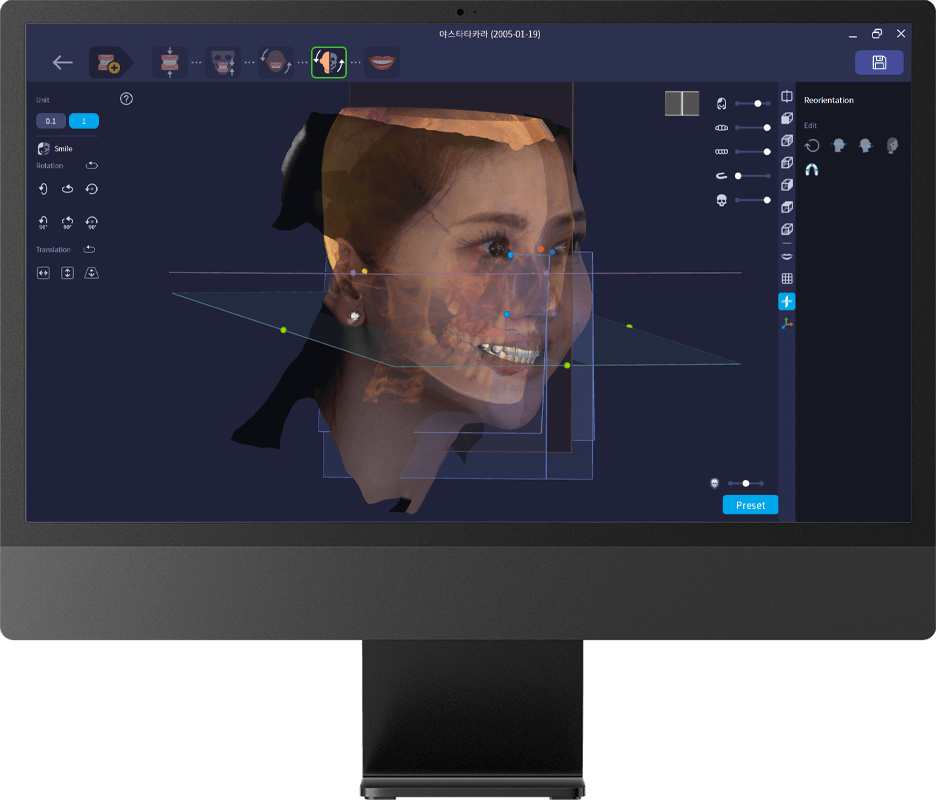 scanner-facciale-rayface-software-intuitivo-smile-design